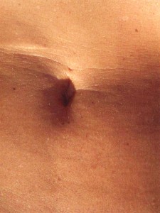 First Scar